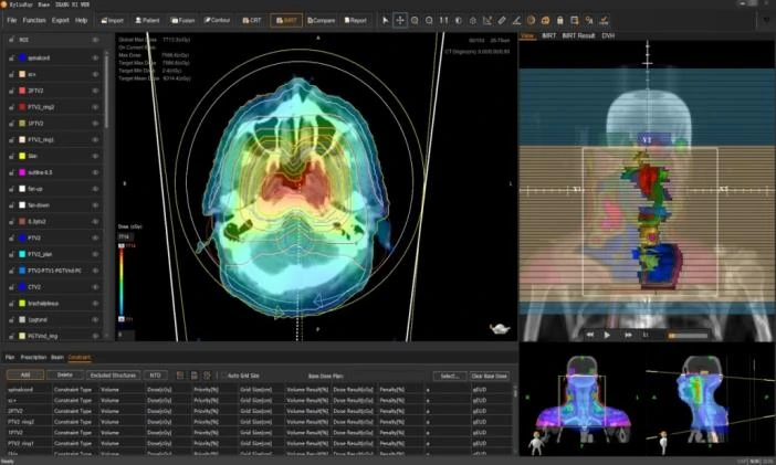 IMRT planning screen with isodose lines over an axial CT slice, beam view and constraint table
